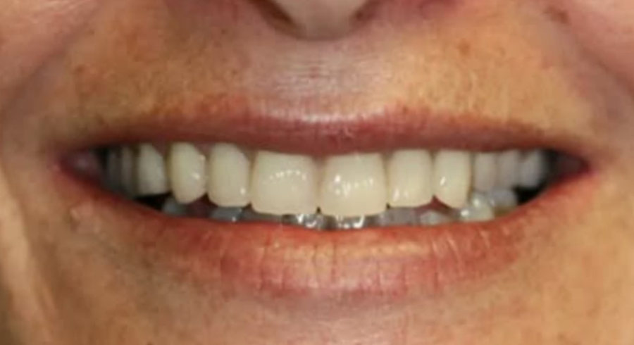 After Dentist Treatment