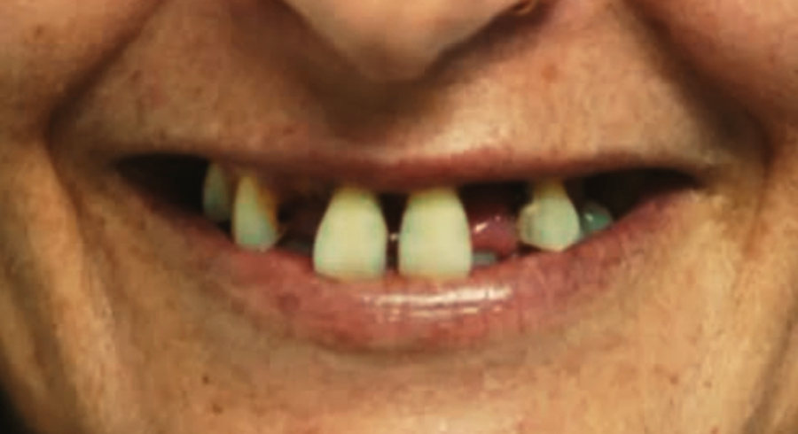 Before Dentist Treatment